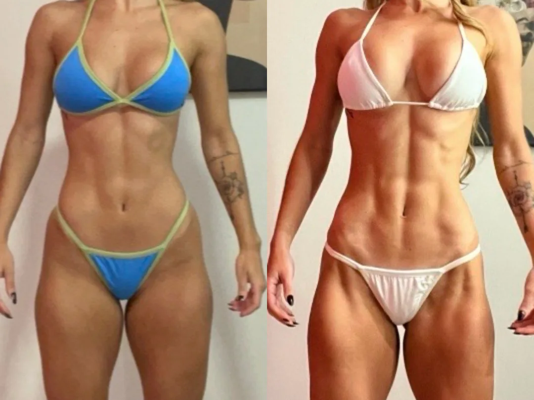 Resultado de emagrecimento e hipertrofia com Carol Trindade — antes e depois 2